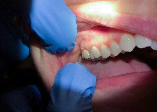 Best Same-Day Emergency Dentist in South Dennis, MA